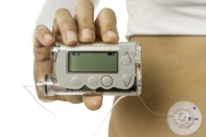 Living with your insulin pump